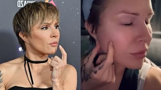 Wściekła Blanka Lipińska odpowiada "zatroskanym" o jej twarz ludziom: "Gdyby blizny znikały po tygodniu, to w życiu bym o tym nie powiedziała!"
