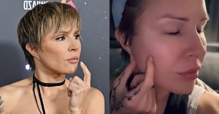 Wściekła Blanka Lipińska odpowiada "zatroskanym" o jej twarz ludziom: "Gdyby blizny znikały po tygodniu, to w życiu bym o tym nie powiedziała!"