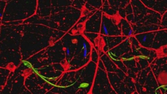 Bioinżynierowie opracowali pierwszą cybertkankę 1