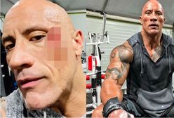 Dwayne Johnson miał wypadek na siłowni. Nagrał krwawe wideo