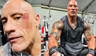 Dwayne Johnson miał wypadek na siłowni. Nagrał krwawe wideo