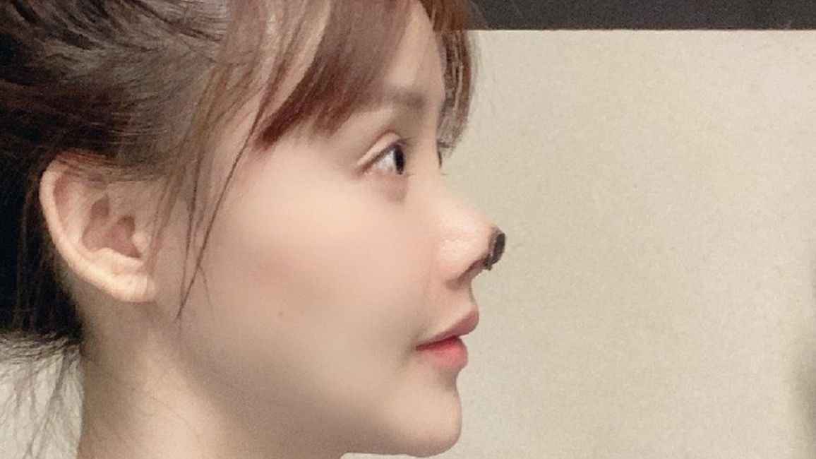 Chińska gwiazda ofiarą nieudanej operacji nosa