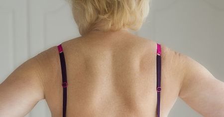 Usunięto jej piersi. Została modelką i reklamuje bieliznę