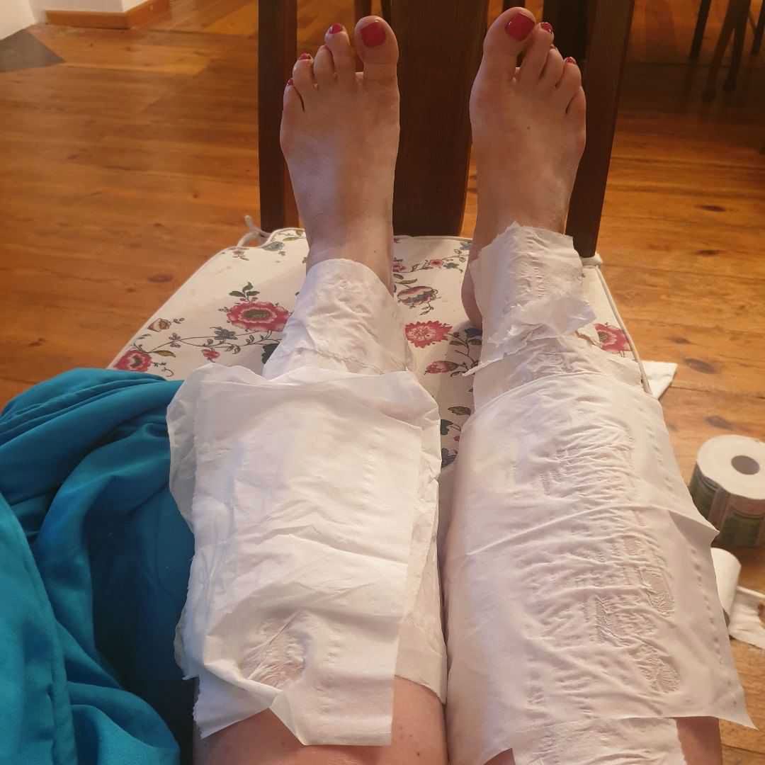 Katarzyna Bosascka ma chore nogi