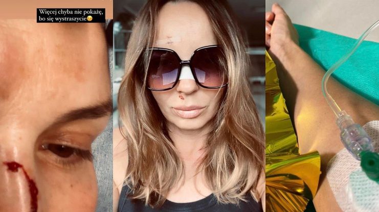 Agnieszka Włodarczyk TRAFIŁA DO SZPITALA