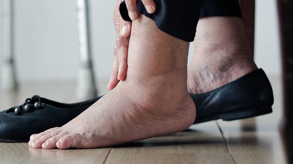 Zauważyłeś ten objaw? Może pojawić się na stopach