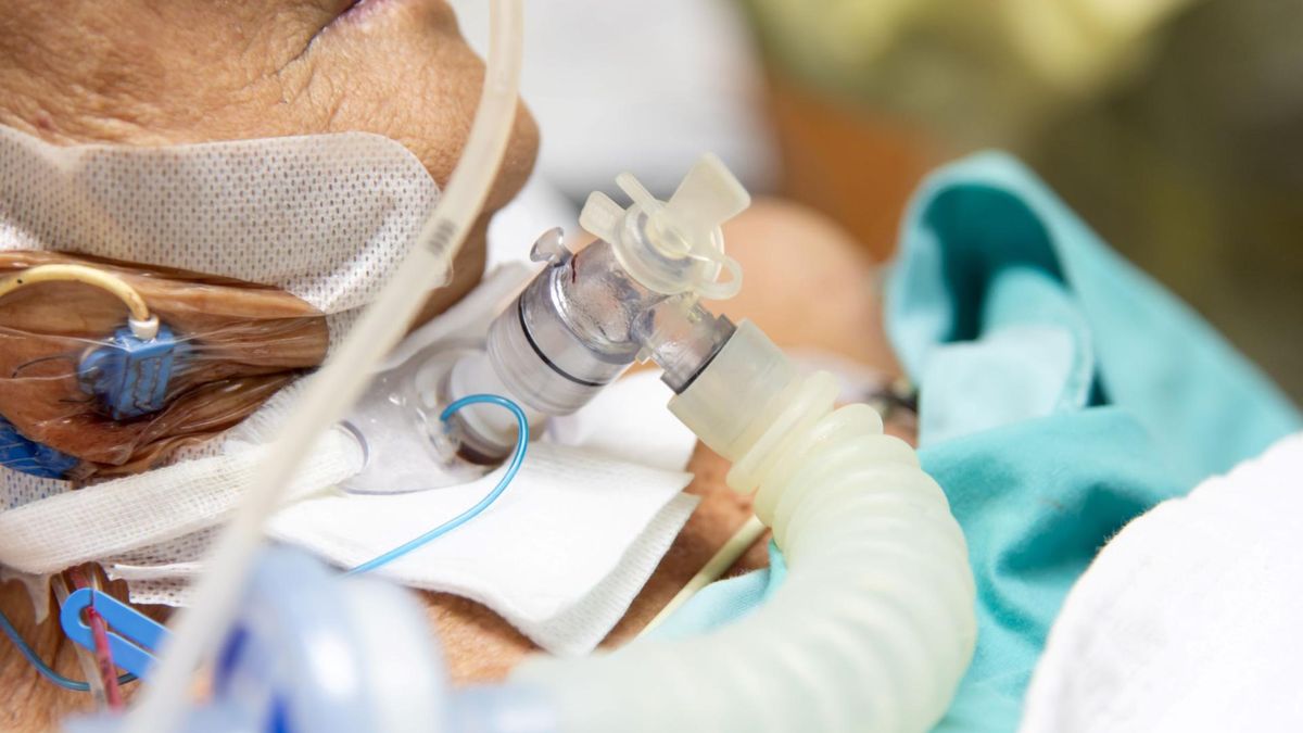 Wycięcie krtani lub jej częściowe usunięcie to zabieg laryngologiczny i jedna z metod chirurgicznego leczenia raka krtani.