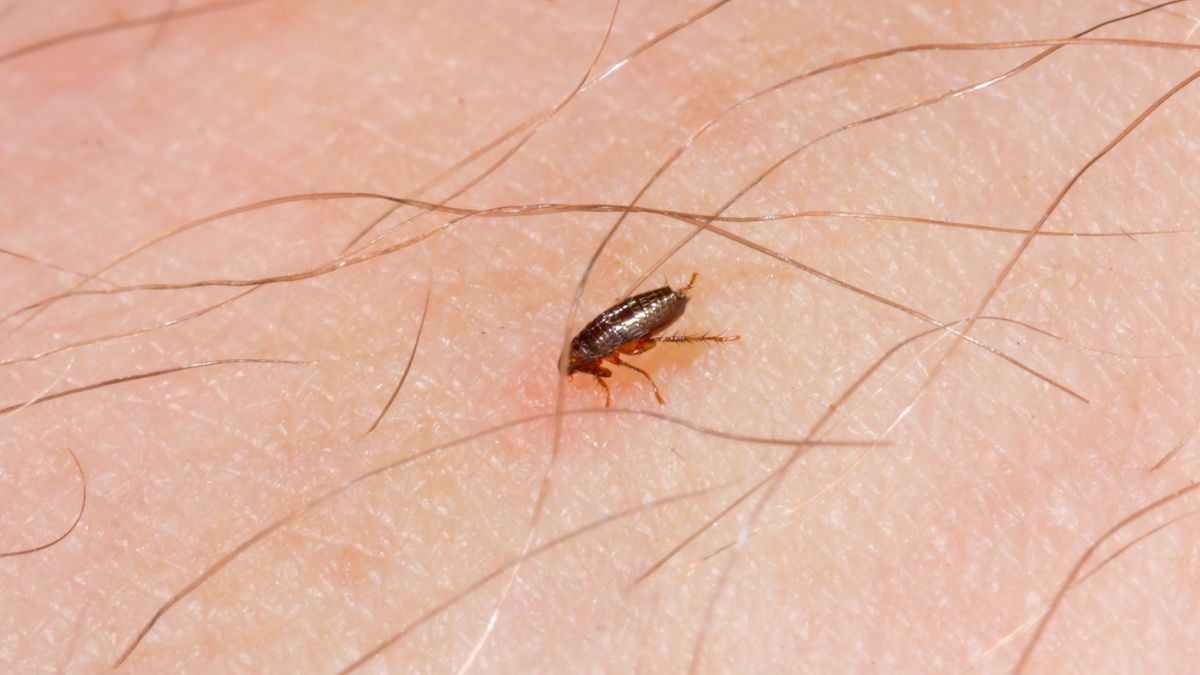 Ugryzienie pchły zazwyczaj objawia się w postaci zaczerwienionej zmiany na skórze.