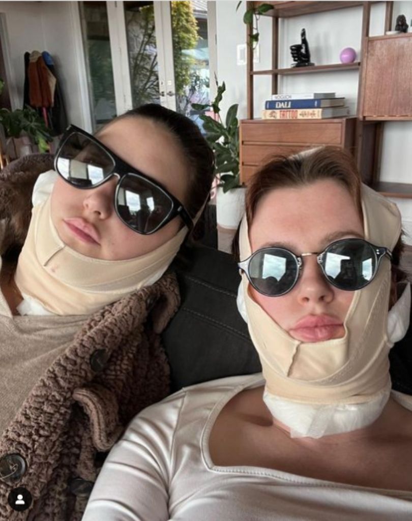 Ireland Baldwin tłumaczy się z zabiegu podbródka
