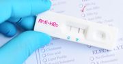 Antygen hbs – badanie, wirusowe zapalenie wątroby typu B