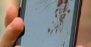 Motorola Milestone 2 wybuchła przy uchu Amerykanina