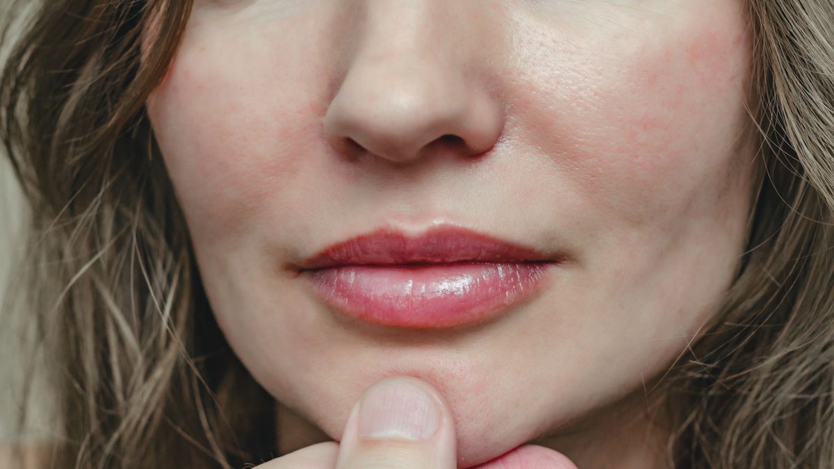 Cofnięty podbródek spowodowany wadą zgryzu można skorygować aparatem ortodontycznym