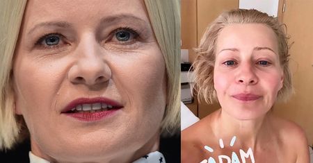 Małgorzata Kożuchowska zrobiła sobie "japoński lifting": "POLIKI WYŻEJ, CZOŁO GŁADKIE"