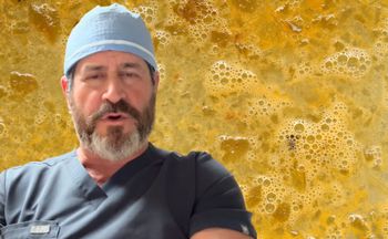 Nic tak nie postarza. Kardiochirurg odradza każdemu