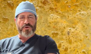 Nic tak nie postarza. Kardiochirurg odradza każdemu