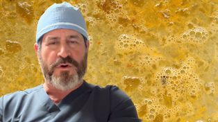 Nic tak nie postarza. Kardiochirurg odradza każdemu