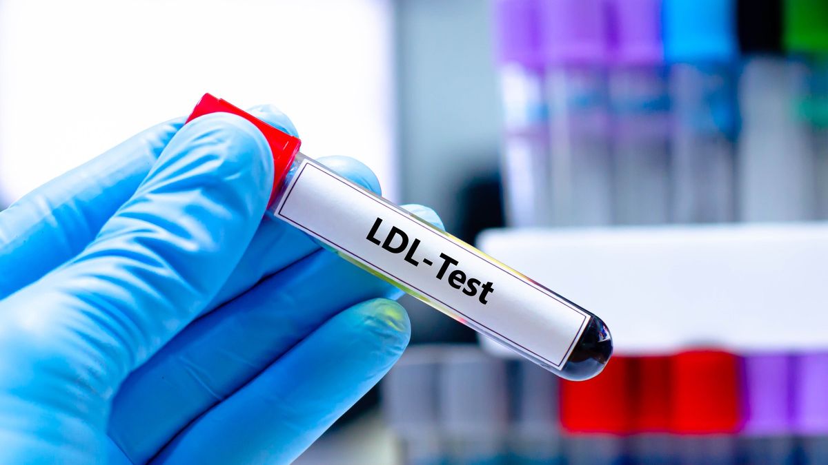 Blood sampling tube
Blood sampling tube for LDL test analysis.
Kitsawet Saethao
health, medical, profile, analysis, triglycerides, ldl, healthy, hdl, clinical, wellness, management, nutrition, results, test, word, healthcare, lipid profile, notebook, life, disease, lifestyle, online, read, white, browsing, connect, leisure, coffee, retired, senior, lab, health care, cardiovascular, ldl test, ldl blood test, ldl level, ldl analysis