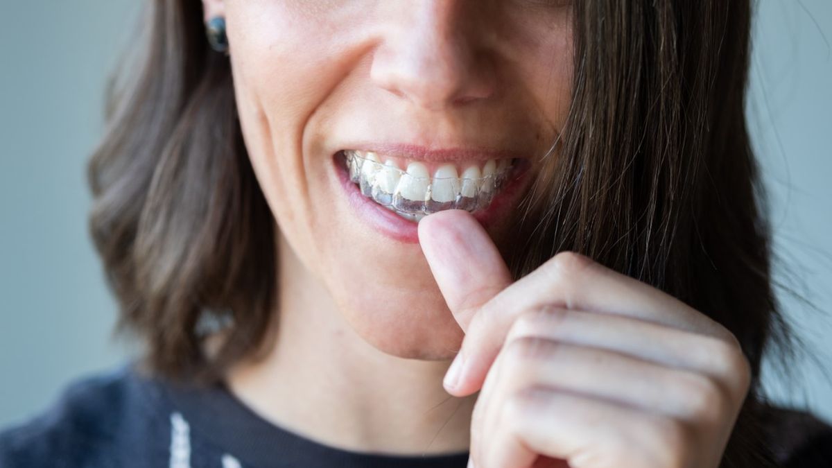 Invisalign to nakładki, które mają wiele zalet. Ich przewagą nad zwykłym aparatem jest to, że są niewidoczne, dyskretne i higieniczne.
