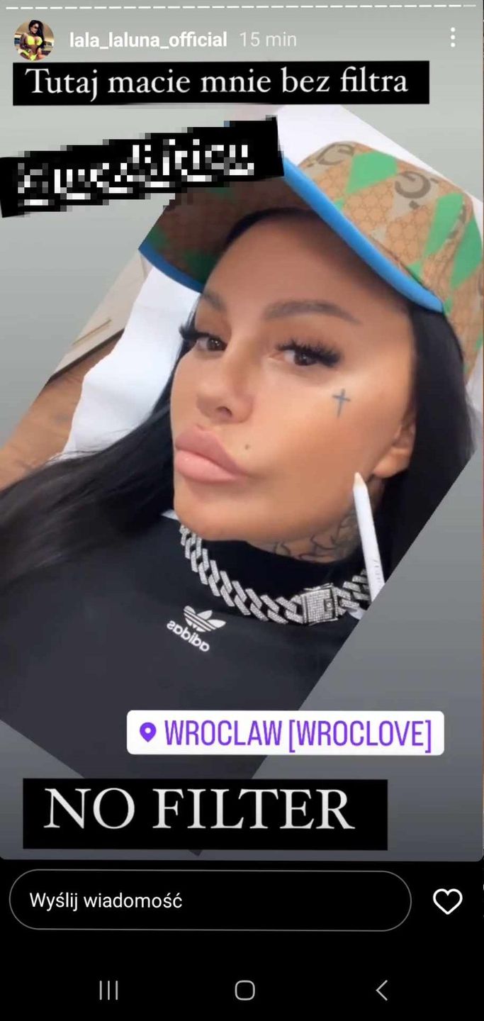 Laluna bez filtra