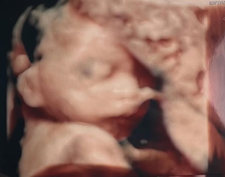 Marta Kubacka jest w ciąży