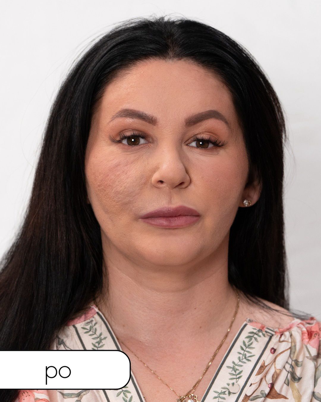 Uczestniczka programu "Anatomia piękna" po metamorfozie