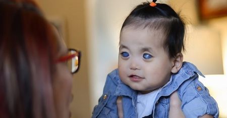 Od adopcji minęło już sześć lat. Jak teraz wygląda dziewczynka o srebrnych oczach?