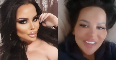 Esmeralda Godlewska pokazuje zdjęcia sprzed operacji. "Od zawsze byłam prześladowana za to, jak wyglądam" (FOTO)