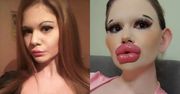 "Bułgarska Barbie" przeszła szokującą metamorfozę. Twierdzi, że ma NAJWIĘKSZE USTA na świecie! (FOTO)