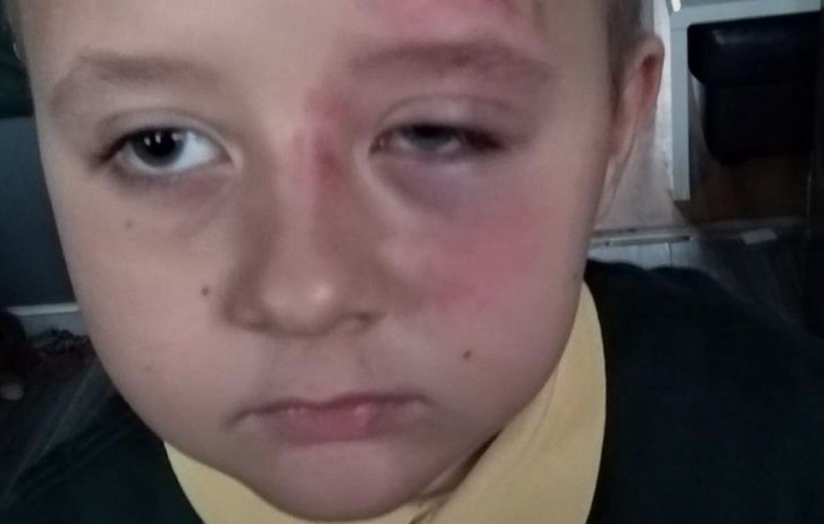 7-letni Gabryś pobity w brytyjskiej szkole. Wstrząsający powód