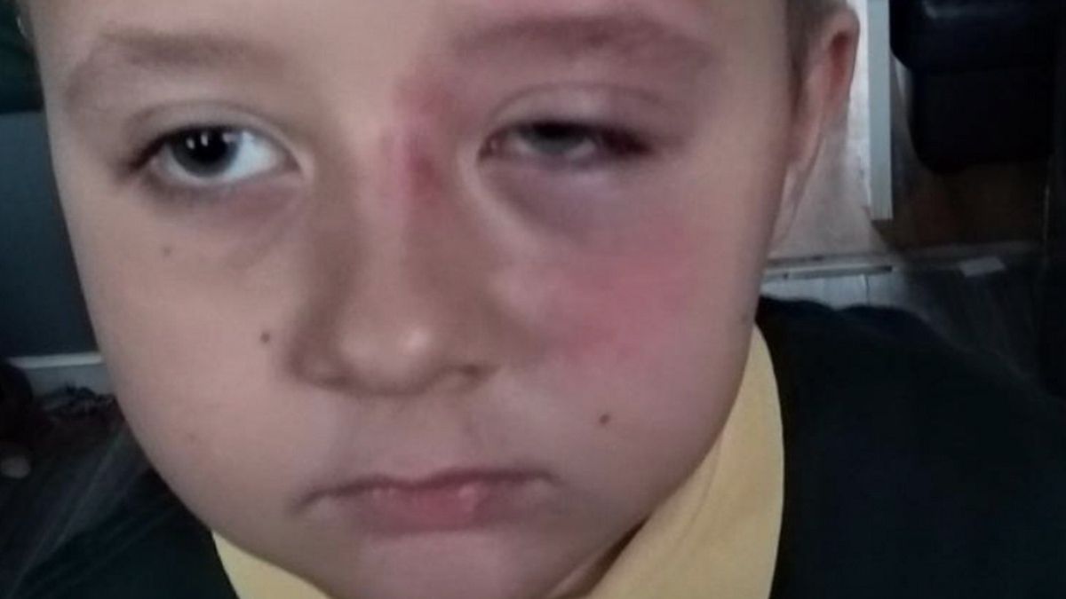 Gabryś został pobity w szkole