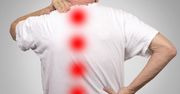 Przepuklina kręgosłupa - przyczyny, objawy, leczenie, operacja, ćwiczenia