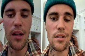 Justin Bieber boryka się z poważną chorobą. Piosenkarz ma sparaliżowaną twarz