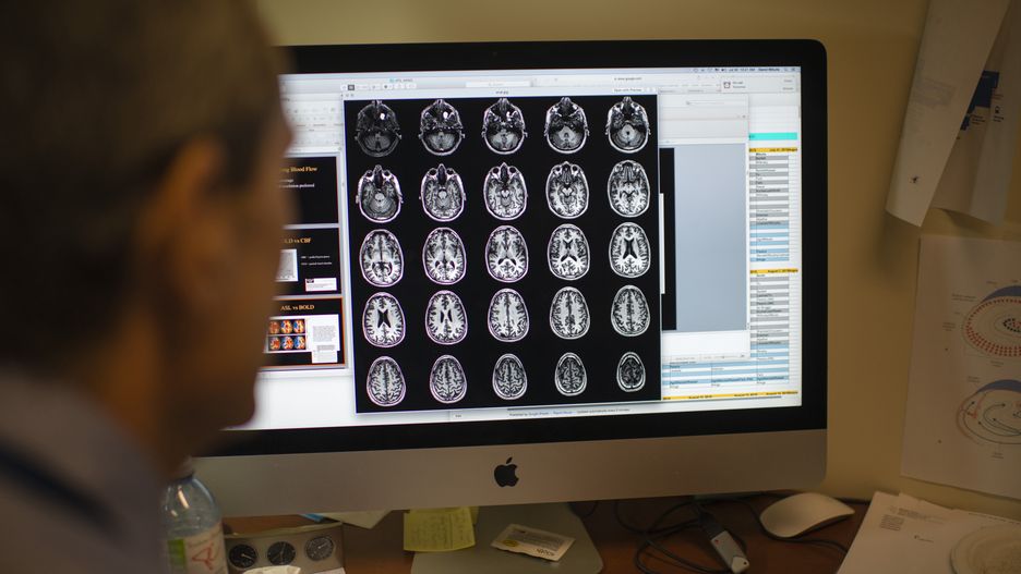 Tłuszcz w mózgu napędza Alzheimera? Nowe badania