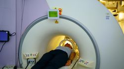 Najtrudniejszy przeciwnik neurochirurgów. Glejaki dominują w statystykach i mają złe rokowania