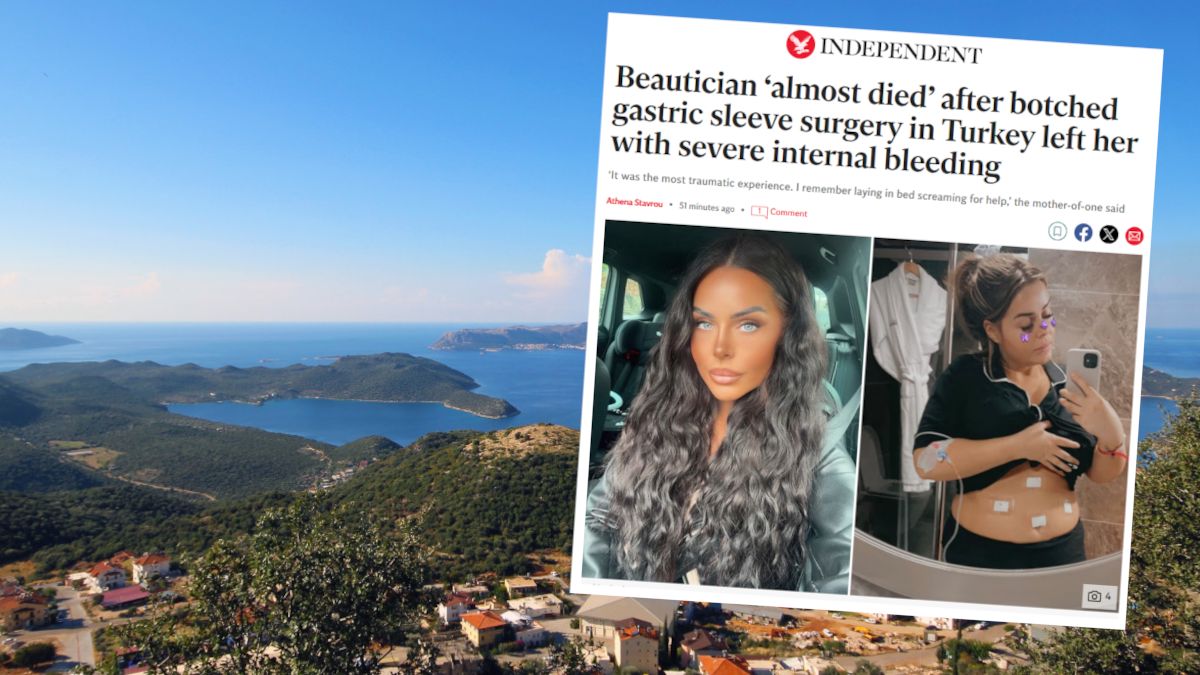 Dramatyczne skutki operacji zmniejszenia żołądka.