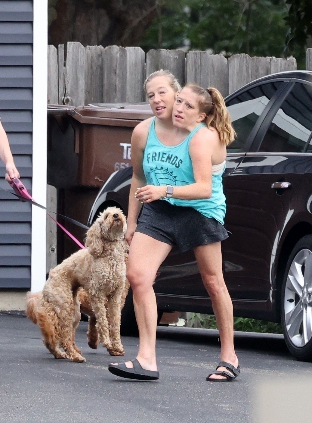 Abby i Brittany Hensel 