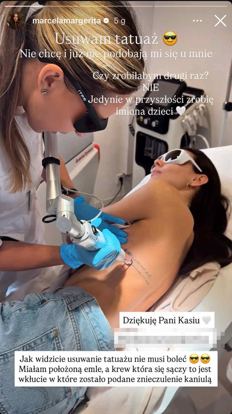 Marcela Leszczak usuwa tatuaż