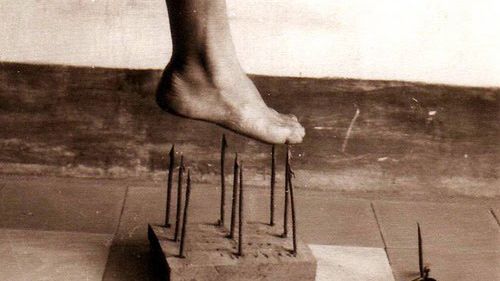 Życie bez bólu jest... bardzo trudne. Poznaj ludzi, których nigdy nic nie boli 1