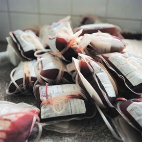 "Złota krew" jest bardzo rzadka. Taką grupę mają tylko 43 osoby na świecie