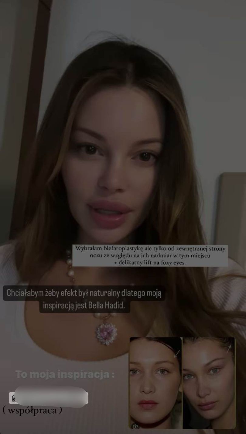 Justyna Gradek relacjonuje pobyt w tureckiej klinice. Zdradziła, na jaki zabieg się zdecydowała