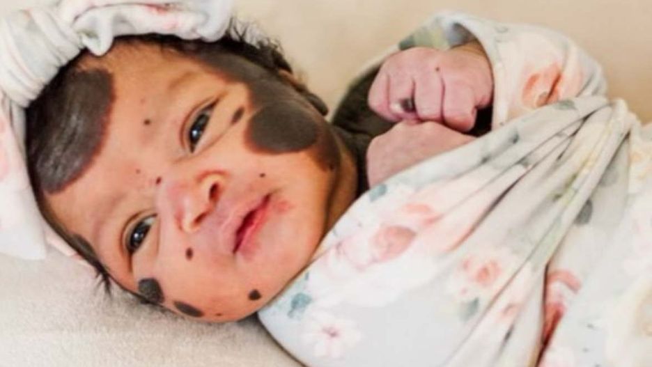 Wygląd dziewczynki wprawił rodziców w osłupienie