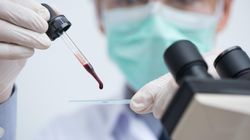 Grupa krwi, która zwiększa ryzyko groźnych nowotworów. "Zostało to naukowo udowodnione"