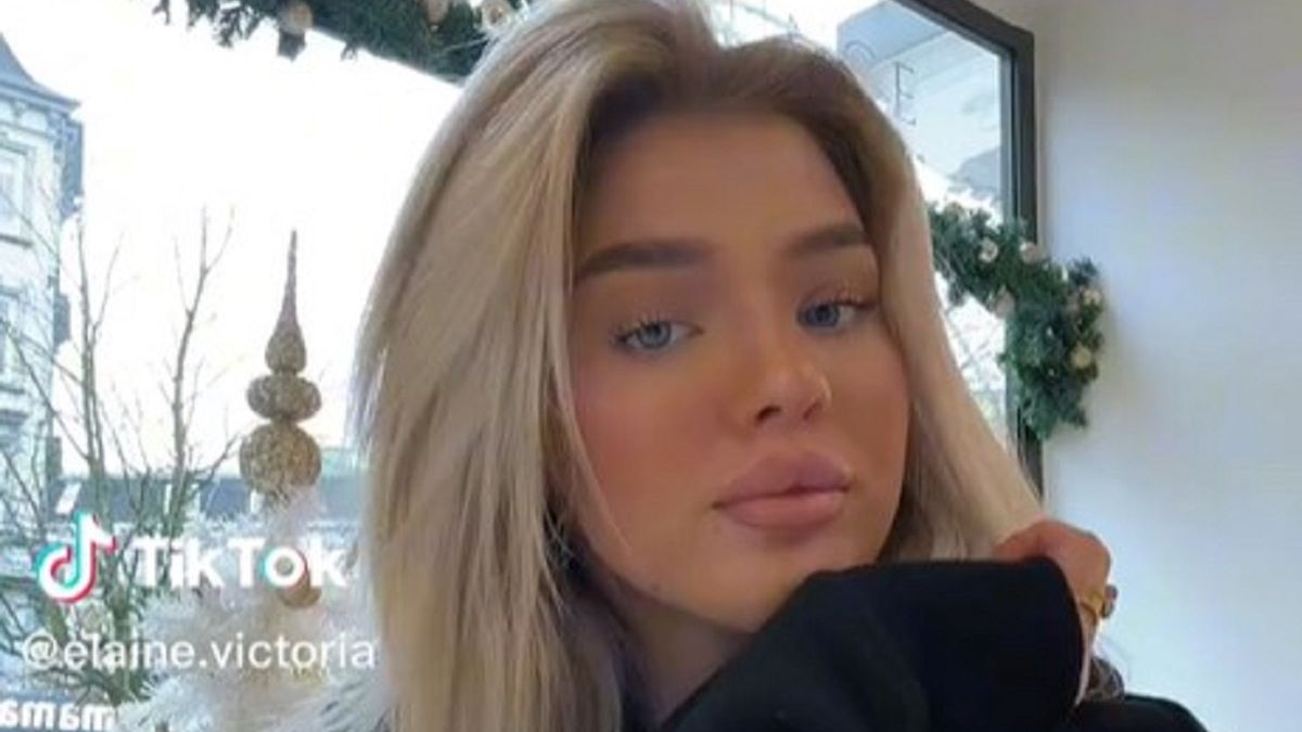 Zrobiła sobie "tureckie zęby". 