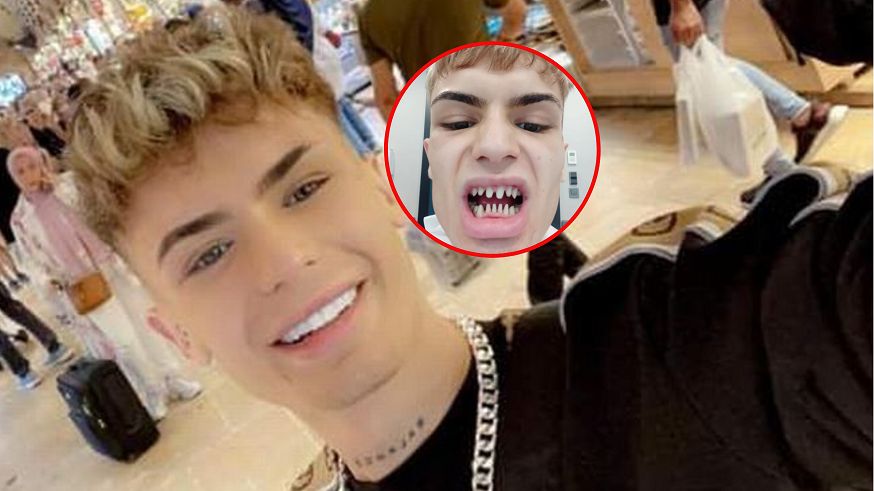 Twierdzi, że przez tureckie zęby wygląda jak rekin. Na tym nie koniec jego problemów