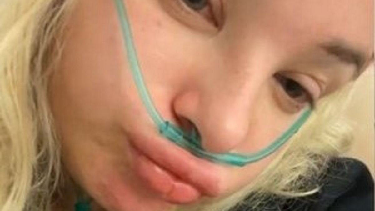 Zawodniczka przeżyła prawdziwy dramat