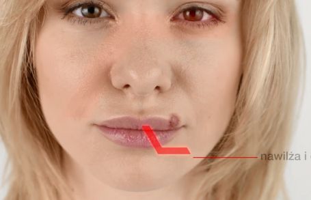 Hascovir Lipożel na opryszczkę reklamowany w telewizji