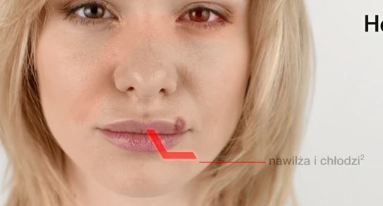 Hascovir Lipożel na opryszczkę reklamowany w telewizji