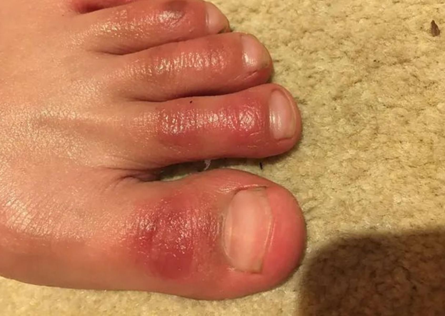 &quot;Covidowe palce&quot;