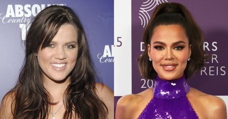 Khloe Kardashian wymienia zabiegi, jakim się poddała: operacja nosa, botoks, nici kolagenowe...