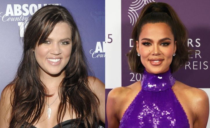 Khloe Kardashian
